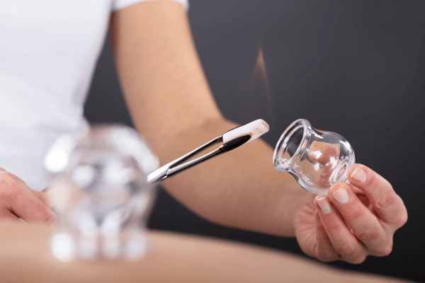 Fire cupping, Hijama for women only in Handsworth, Handsworth Wood, Perry Barr, Birchfield, Witton , Lozells and Aston - Birmingham.